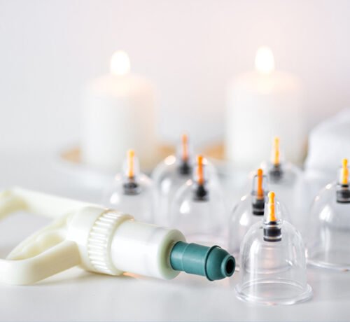 Sunnah-Based Hijama Therapy