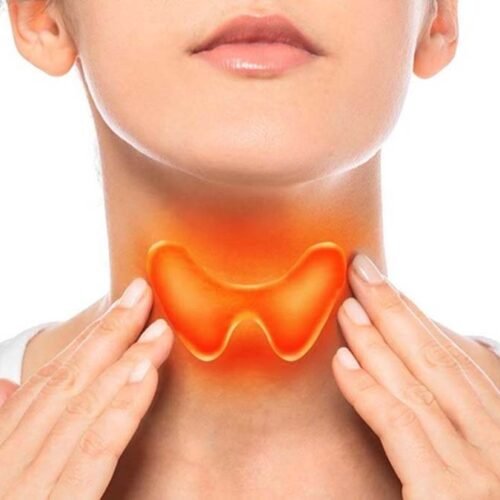 A Holistic Approach to Treating Thyroid Disease: