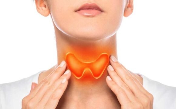 A Holistic Approach to Treating Thyroid Disease: