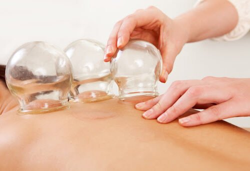 Hijama (Wet Cupping) – Narrations from a Hadeeth regarding Hijama