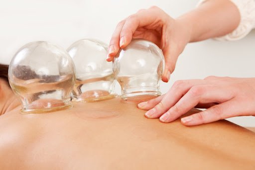 Hijama (Wet Cupping) – Narrations from a Hadeeth regarding Hijama